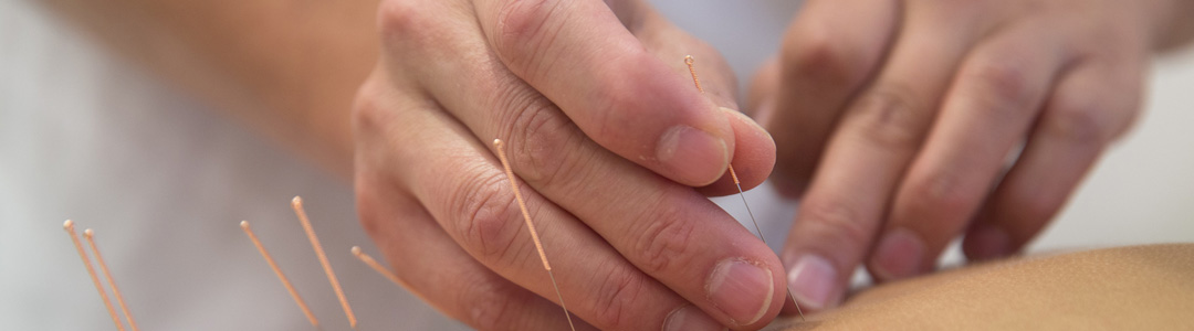 Acupuncture for Smoking Cessation