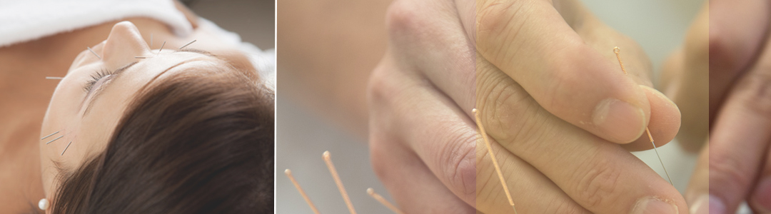 Acupuncture can treat a variety of health concerns